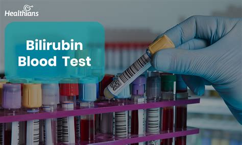 Bilirubin Test: Understanding High vs. Low Levels & Its Causes